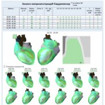 Система скрининга сердца Кардиовизор