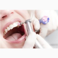 Резинки ApogeyDental полировочные разноцветные КОНУС, 1 шт