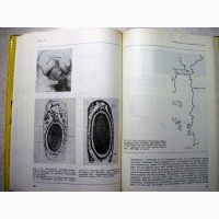 Уотсон Молекулярная биология гена 1978 Наследственность Вирусная теория рака Генетическая