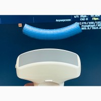 УЗИ/ УЗД Samsung Medison SonoAce R3/ 2014 Рік/ Доплер/ Два датчики