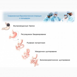 Бариатрическая хирургия - хирургия против ожирения